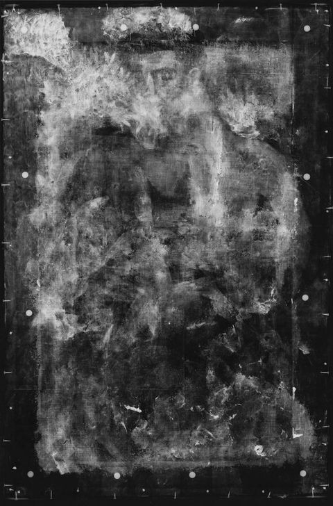 X-radiograph. The ghostly face of a young man is surrounded by a blur of hazy forms in this black and white image.